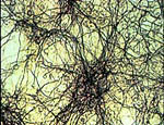 Neural Dendrites